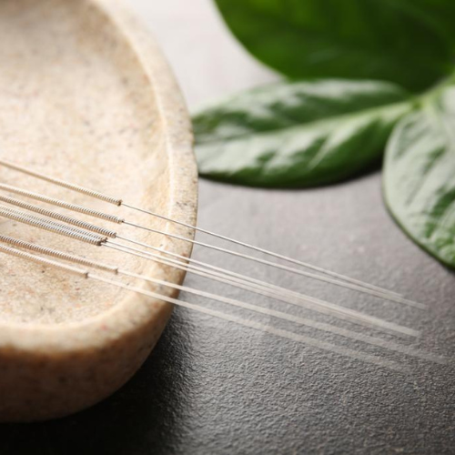 Acuptuncture
