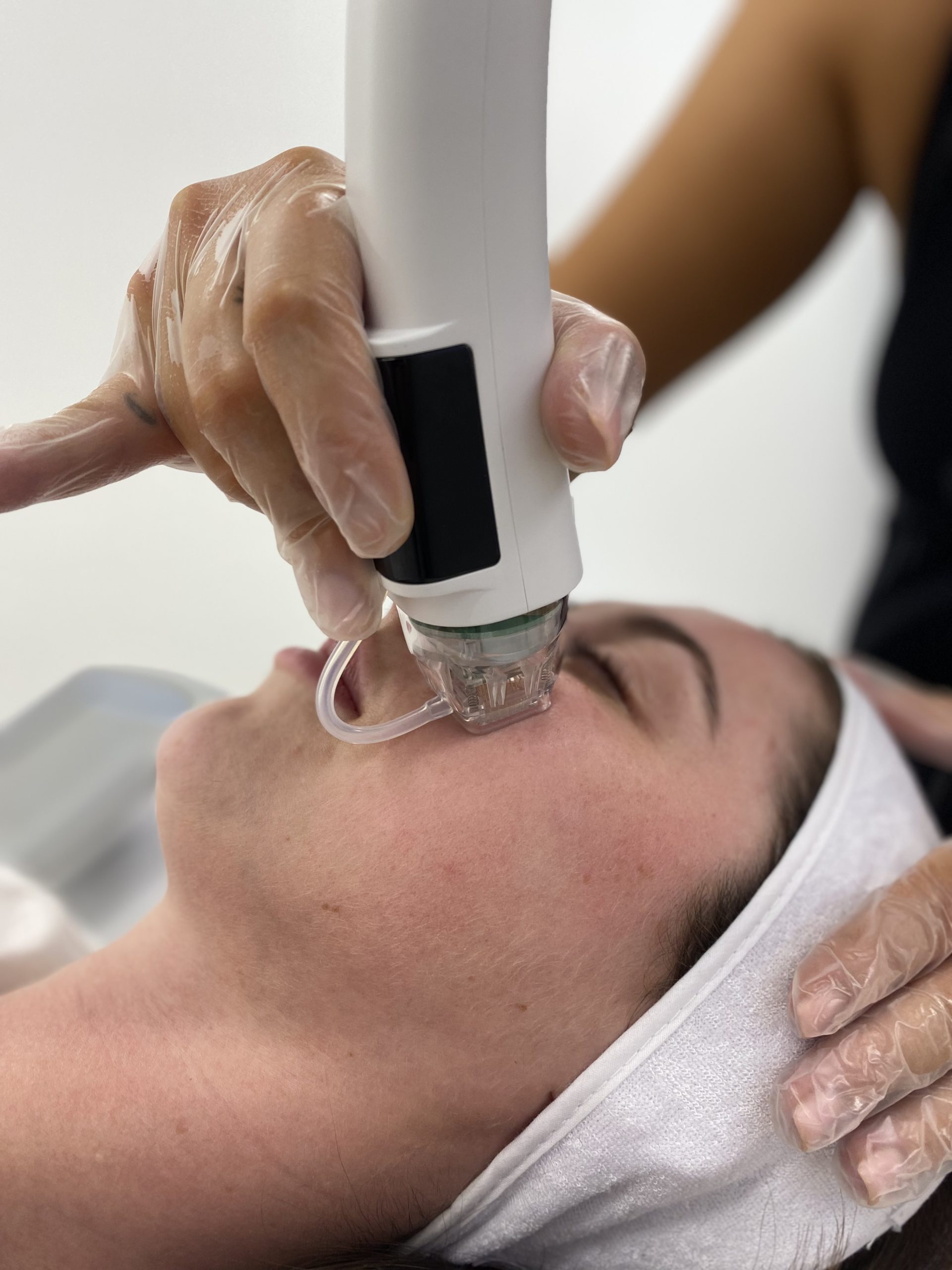 Dermaforce